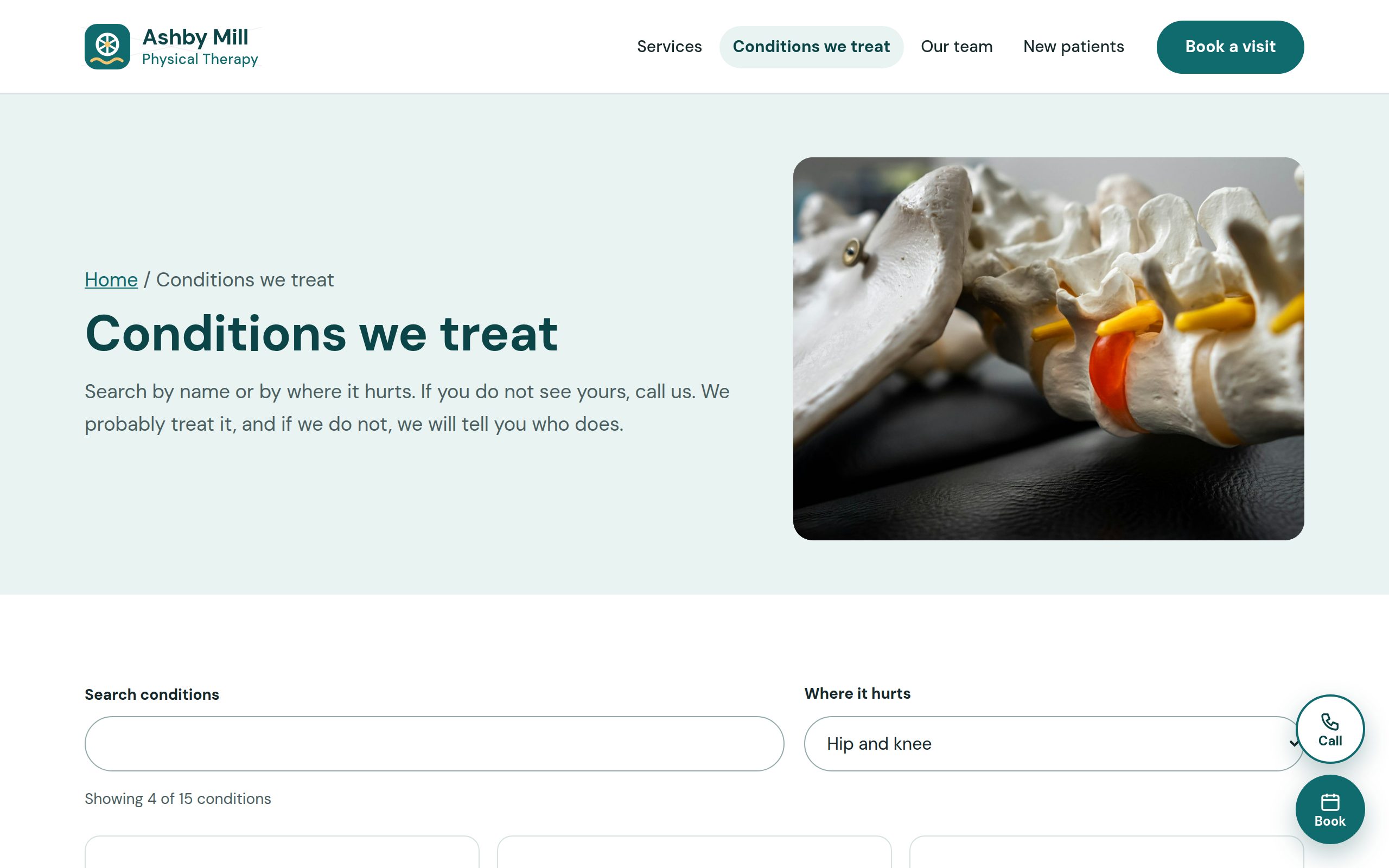 Ashby Mill Physical Therapy conditions page